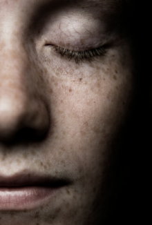 Freckly face.